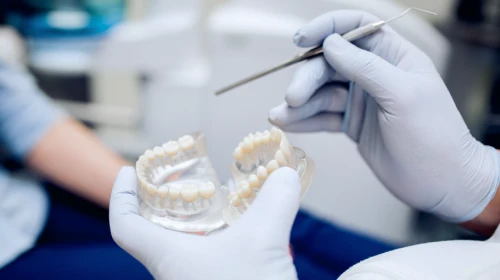 Implantes múltiplos